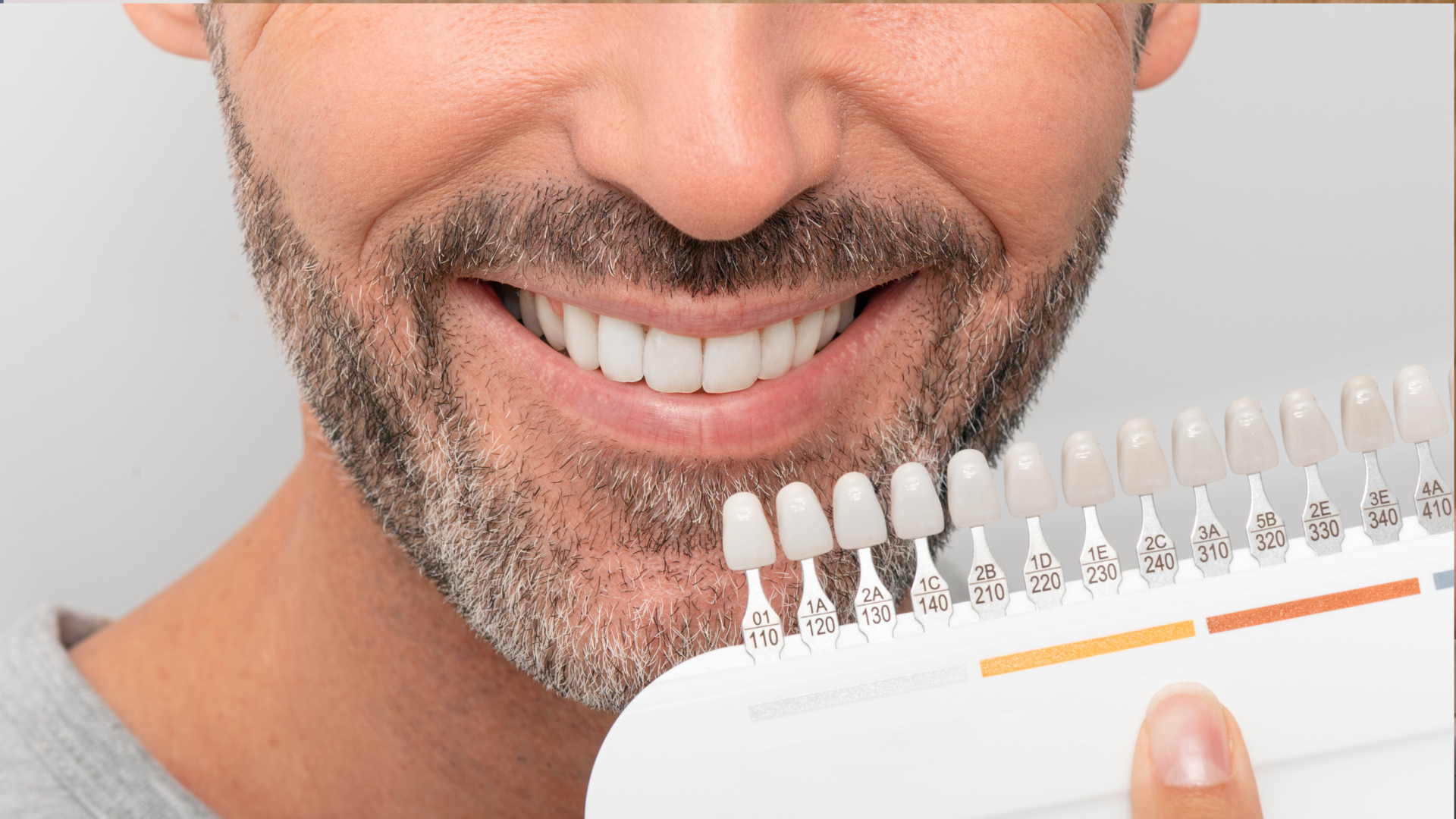A man with a beard is smiling while holding a tooth color chart.