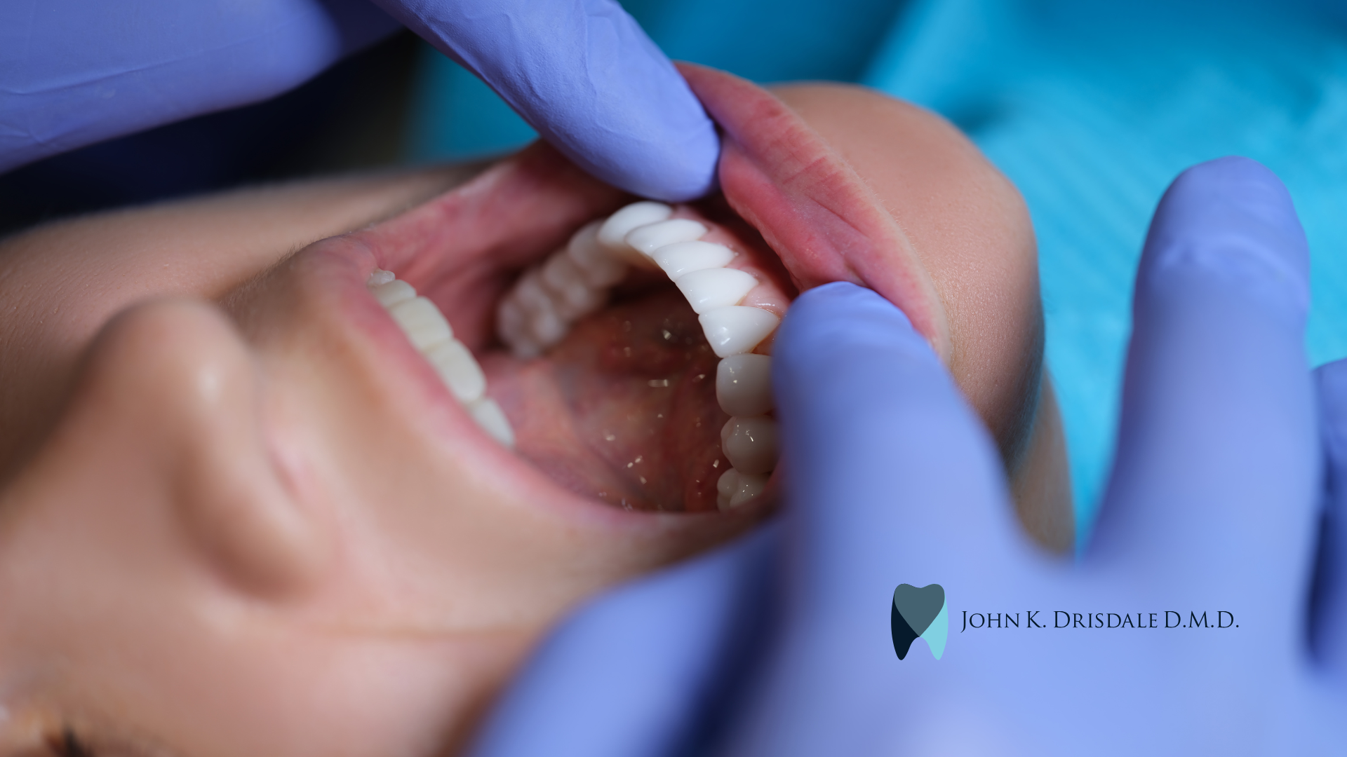 A woman is getting her teeth examined by a dentist.