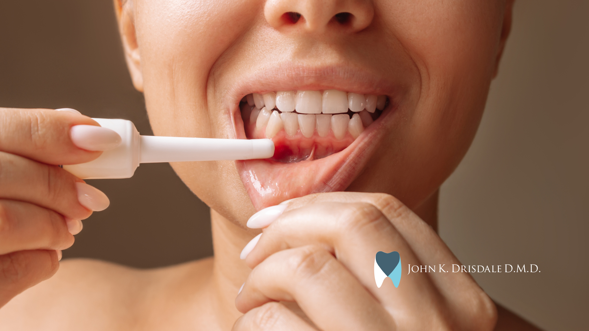 A woman is brushing her teeth with a tube of toothpaste.