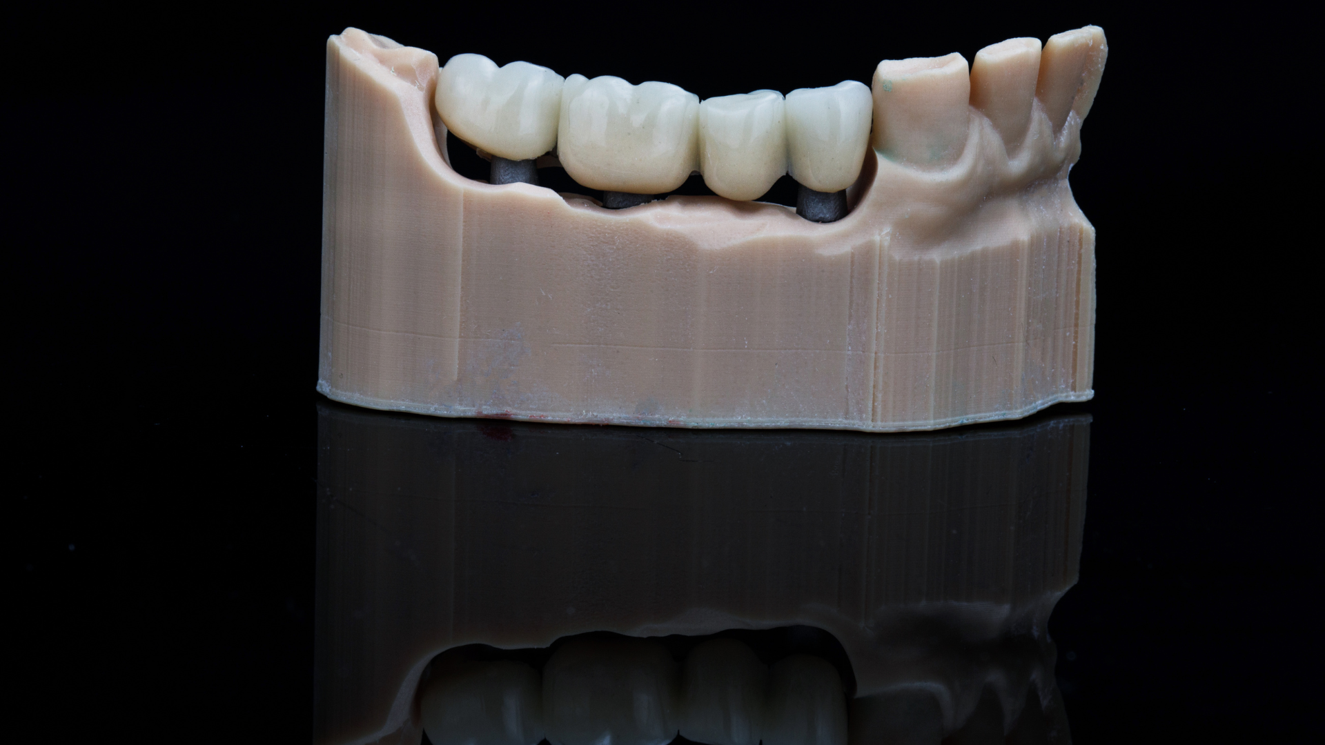 a model of a person 's teeth with a black background .