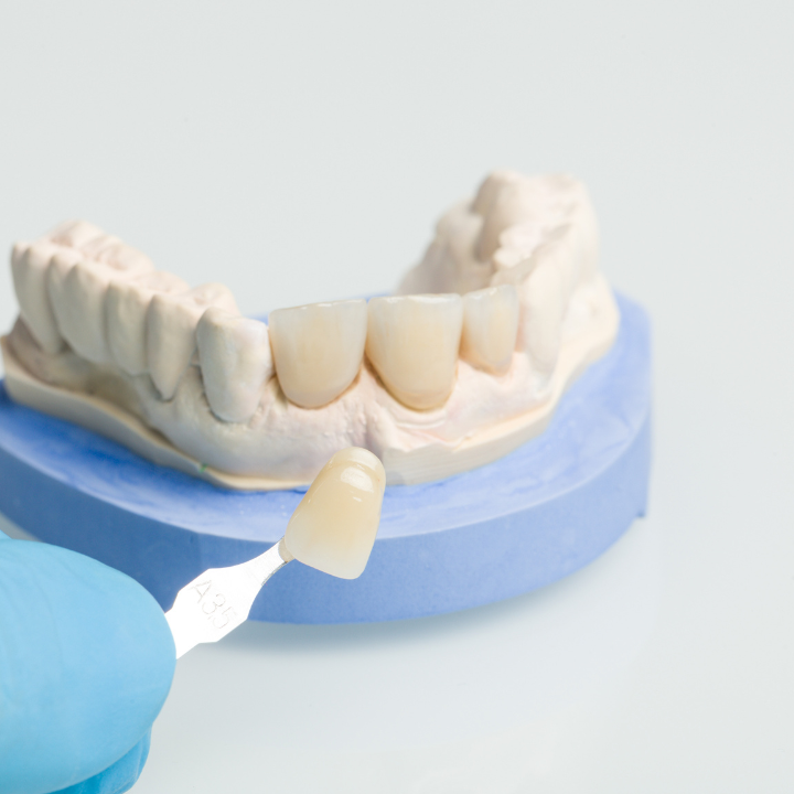 A close up of a person holding a model of teeth