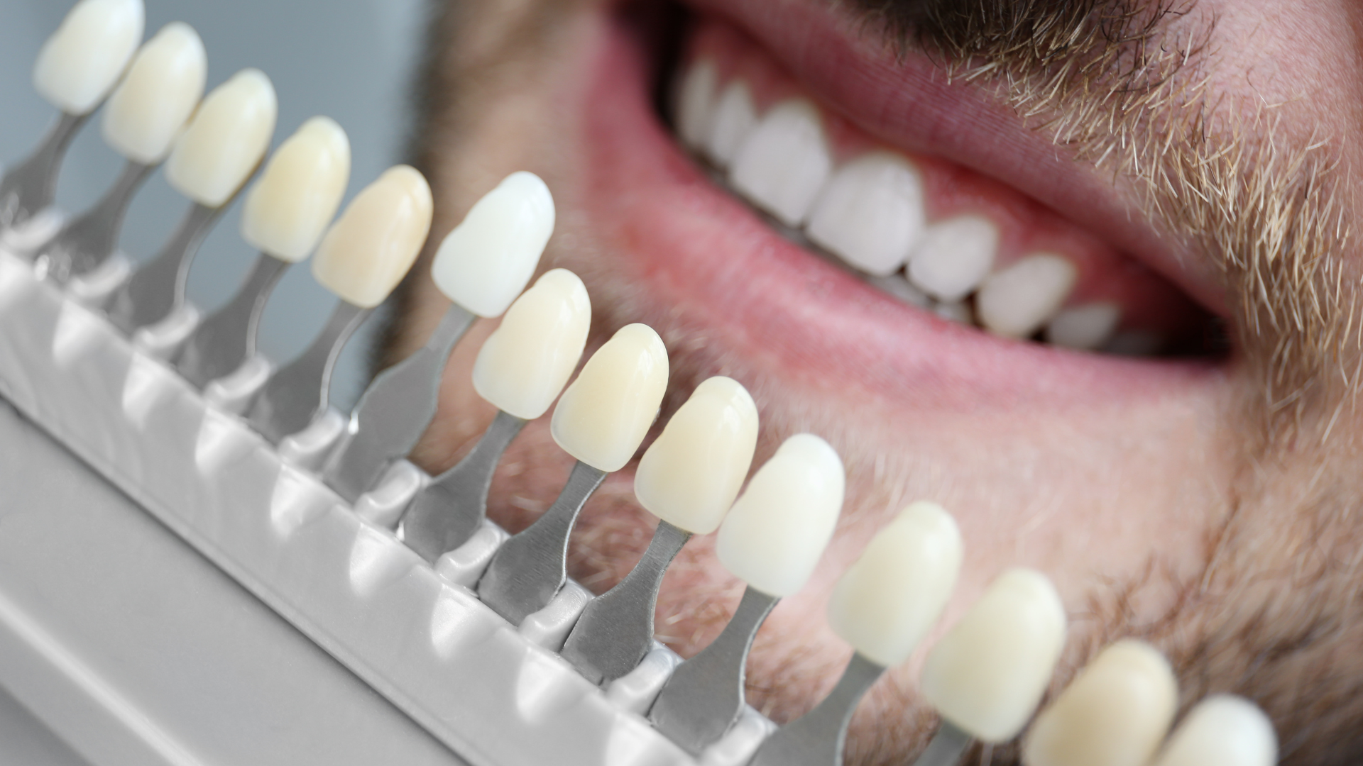 a close up of a man 's teeth next to a tooth color chart .