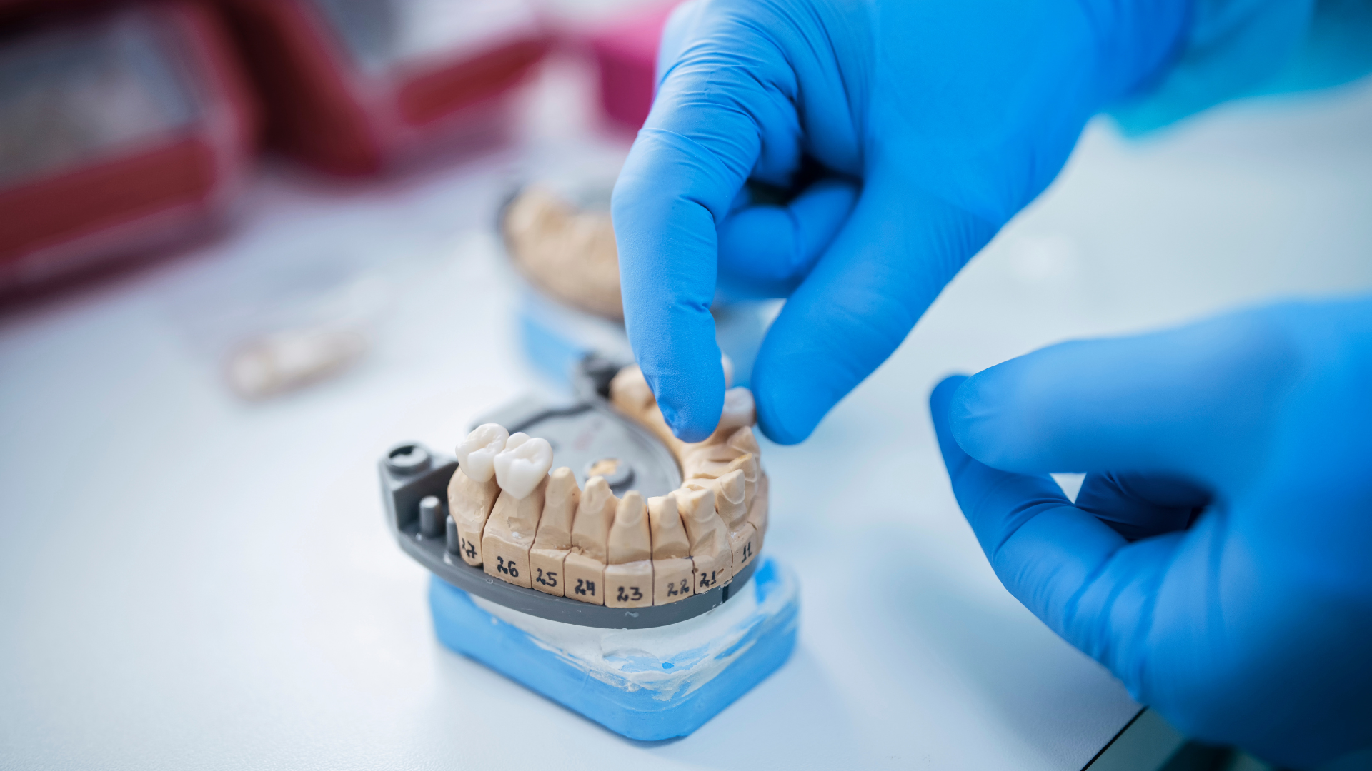 a dentist is working on a model of a person 's teeth .