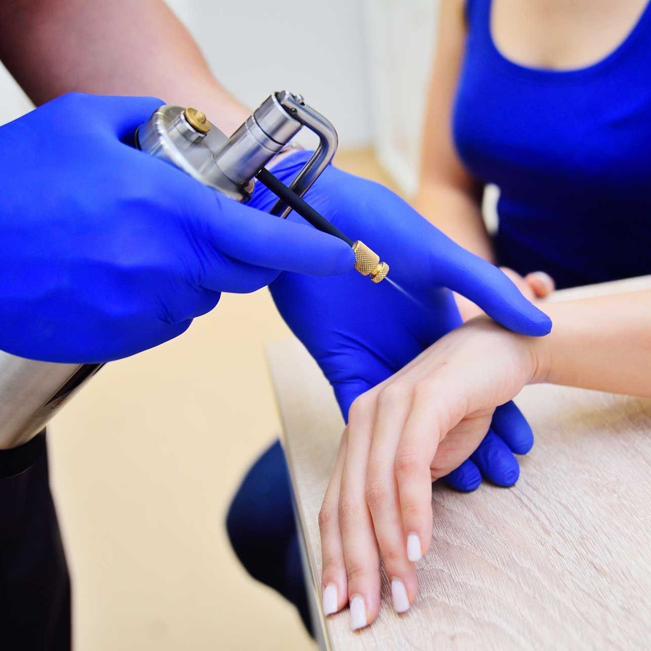 the doctor the dermatologist doing the procedure - cryotherapy