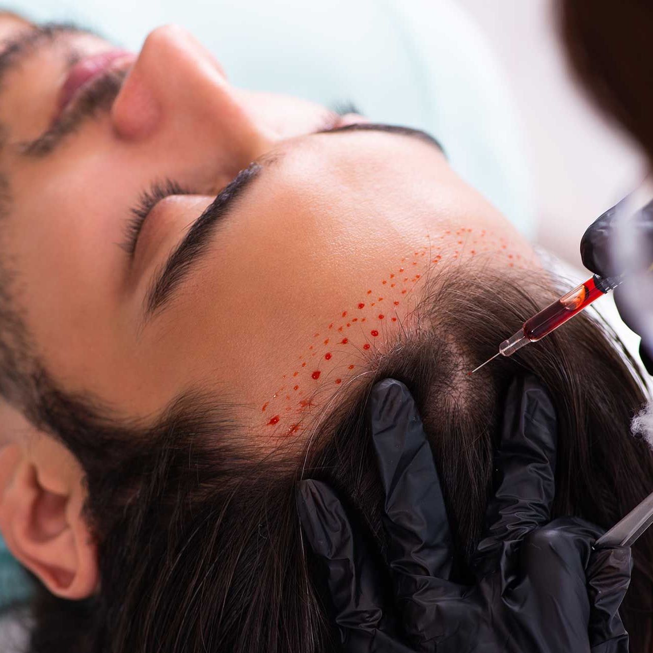 Young man visiting female beautician in hair transplantation con