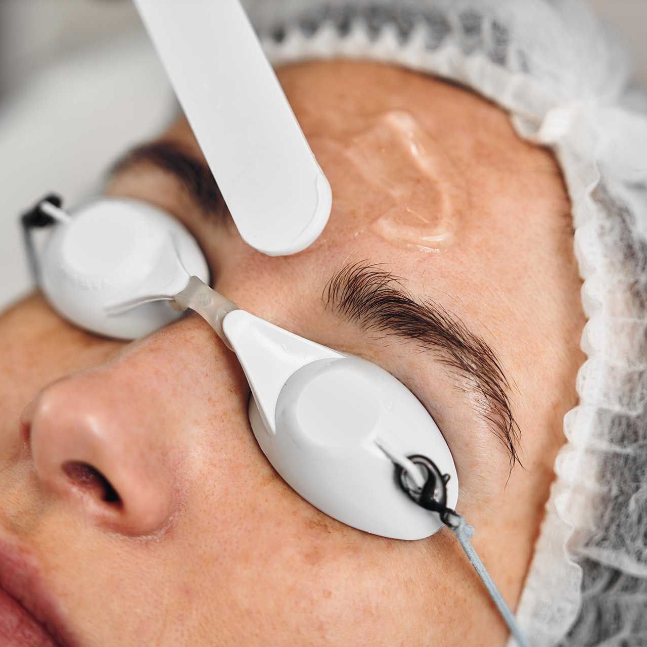 A woman receives IPL therapy in a beauty salon.