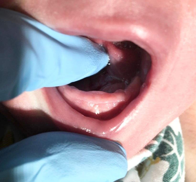 a close up of a baby 's mouth with blue gloves on
