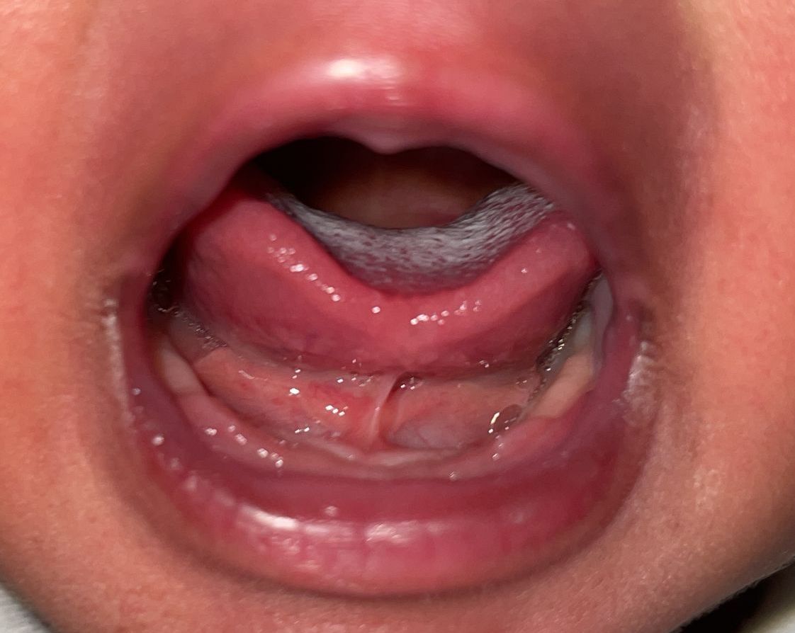 a close up of a baby 's mouth with its tongue sticking out