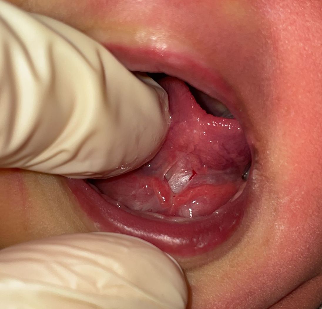 a baby 's mouth is being examined by a person wearing gloves