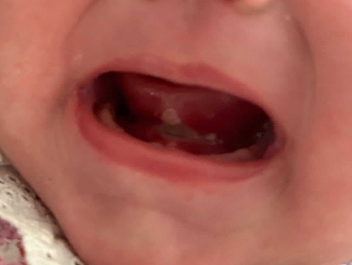 the atp member logo is purple and white and looks like a heart