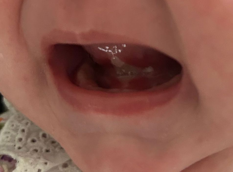 the atp member logo is purple and white and looks like a heart .