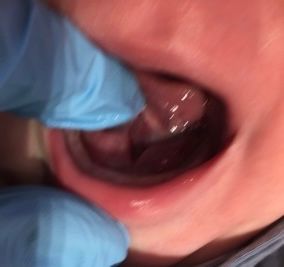 a close up of a baby 's mouth with blue gloves on