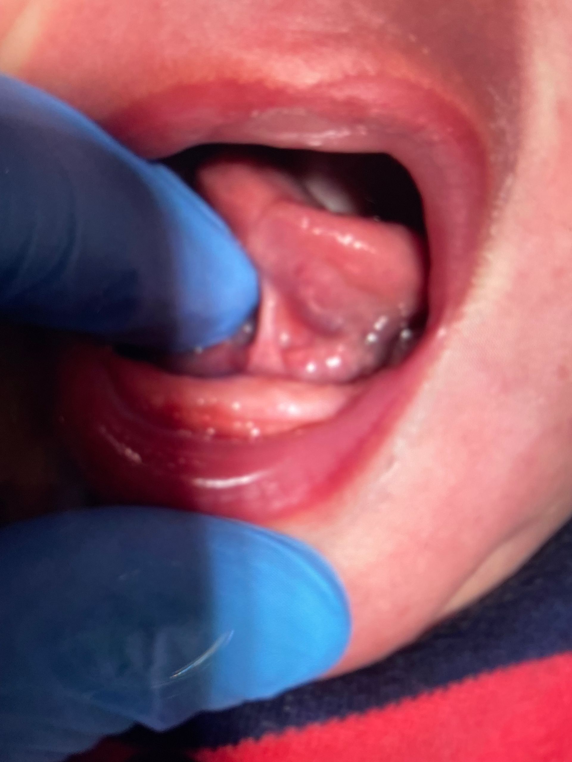 a close up of a baby 's mouth with blue gloves on
