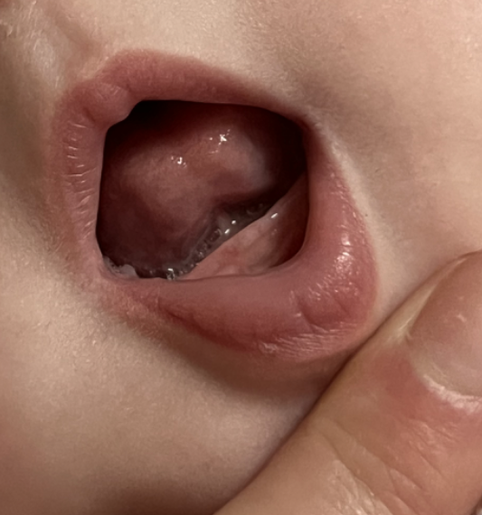 a close up of a baby 's mouth with its tongue sticking out 