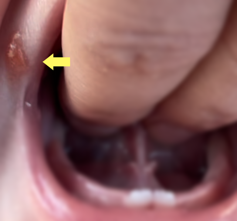 the atp member logo is purple and white and looks like a heart 