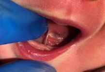 a close up of a baby 's mouth with blue gloves on