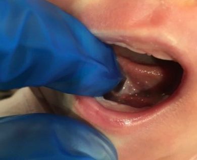a close up of a baby 's mouth with blue gloves on