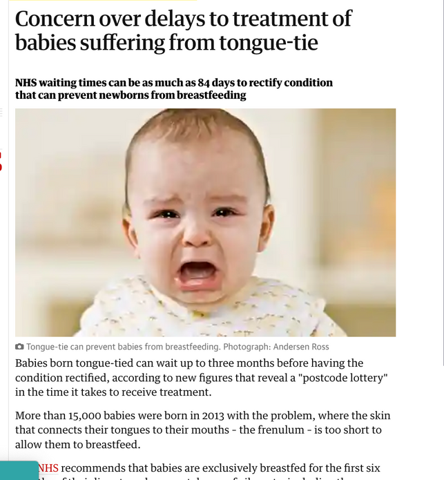 a baby is crying with the words concern over delays to treatment of babies suffering from tongue tie 