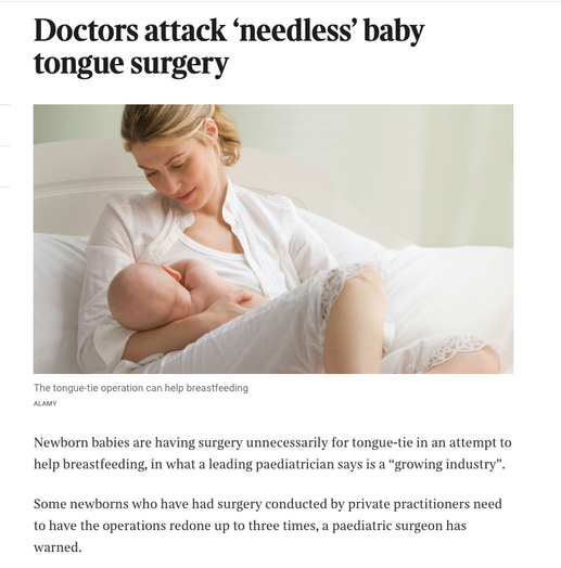 a woman is breastfeeding a baby and the article says doctors attack needleless baby tongue surgery 
