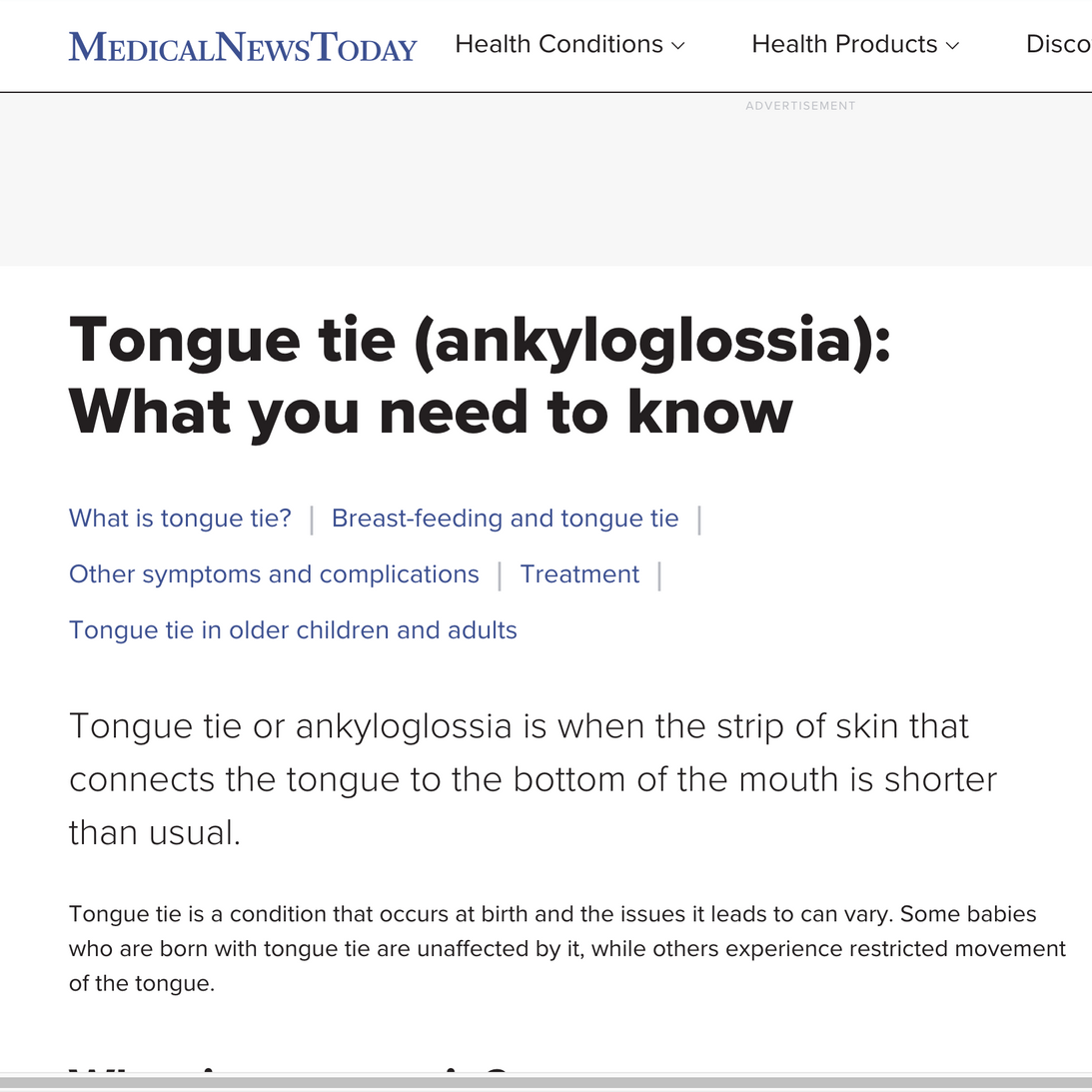 a screenshot of a medical news today article about tongue tie 