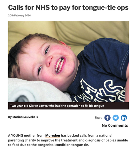 a picture of a baby laying on a bed with the caption calls for nhs to pay for tongue-tie ops 