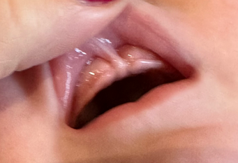 a close up of a baby's mouth with its tongue sticking out