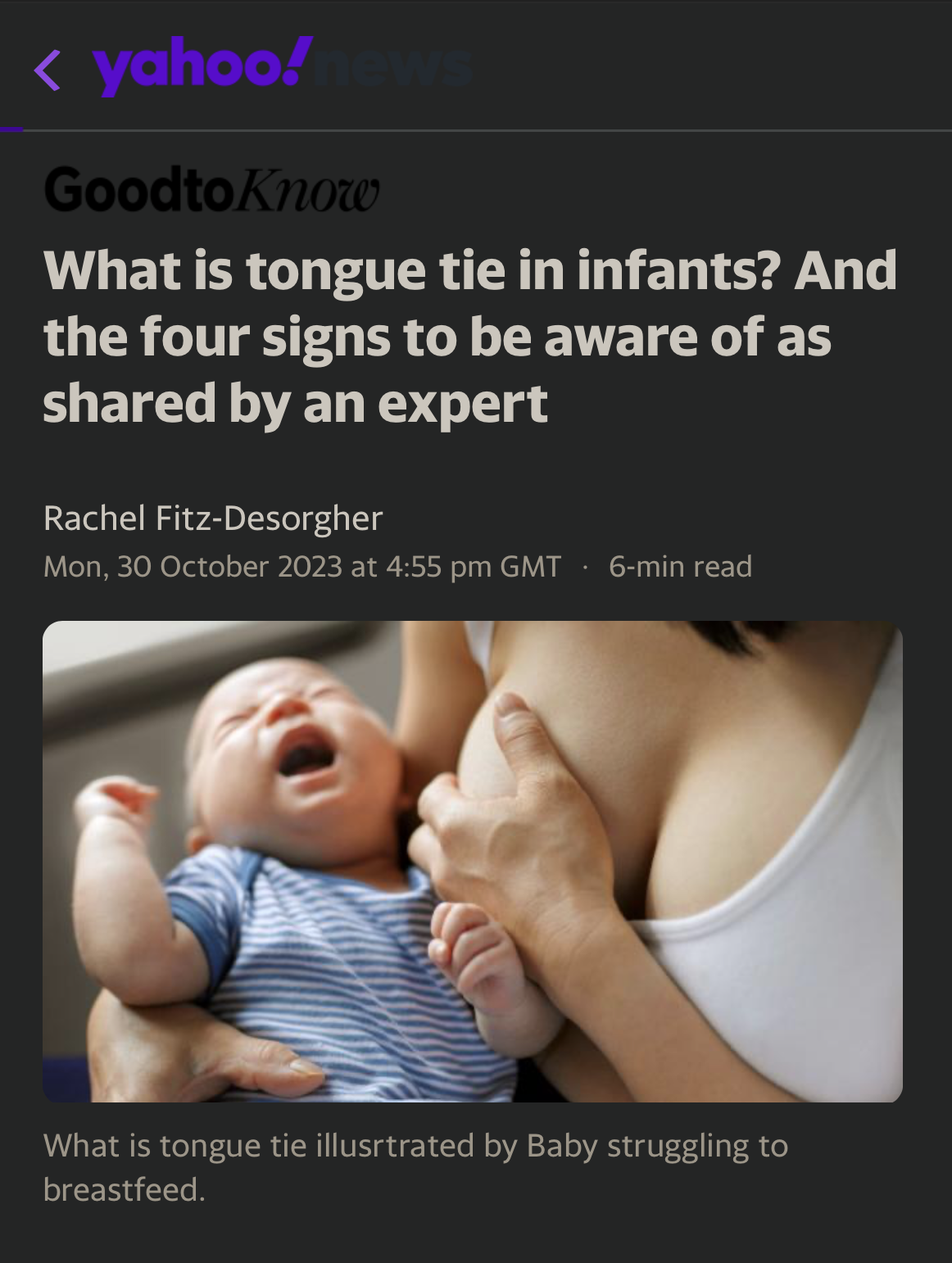 a yahoo article about tongue tie in infants 
