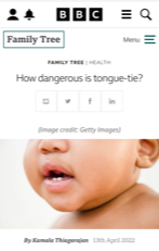 a baby 's face is shown on a bbc website 