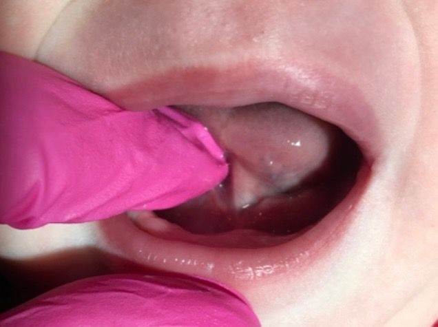 a close up of a baby's mouth with its tongue sticking out