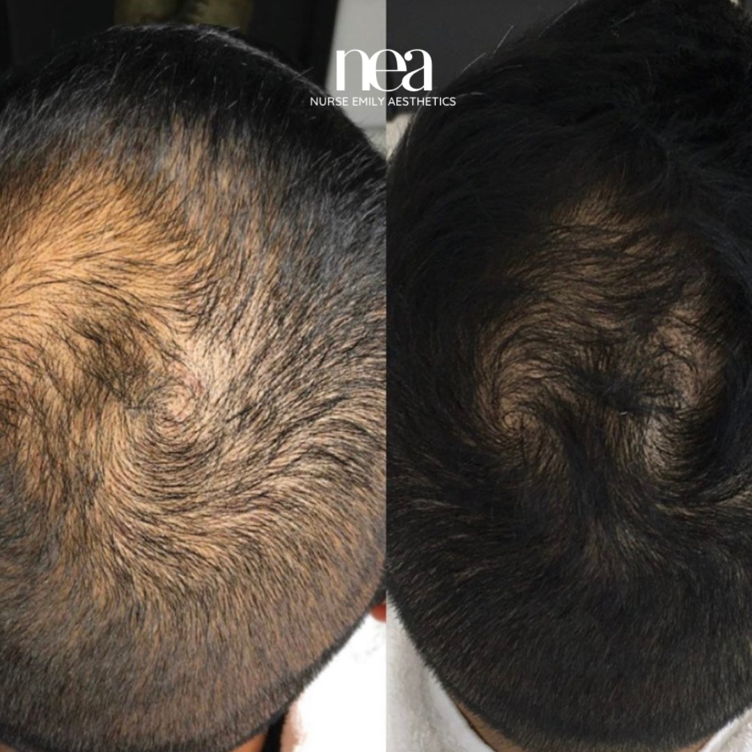 A before and after photo of a man 's hair.