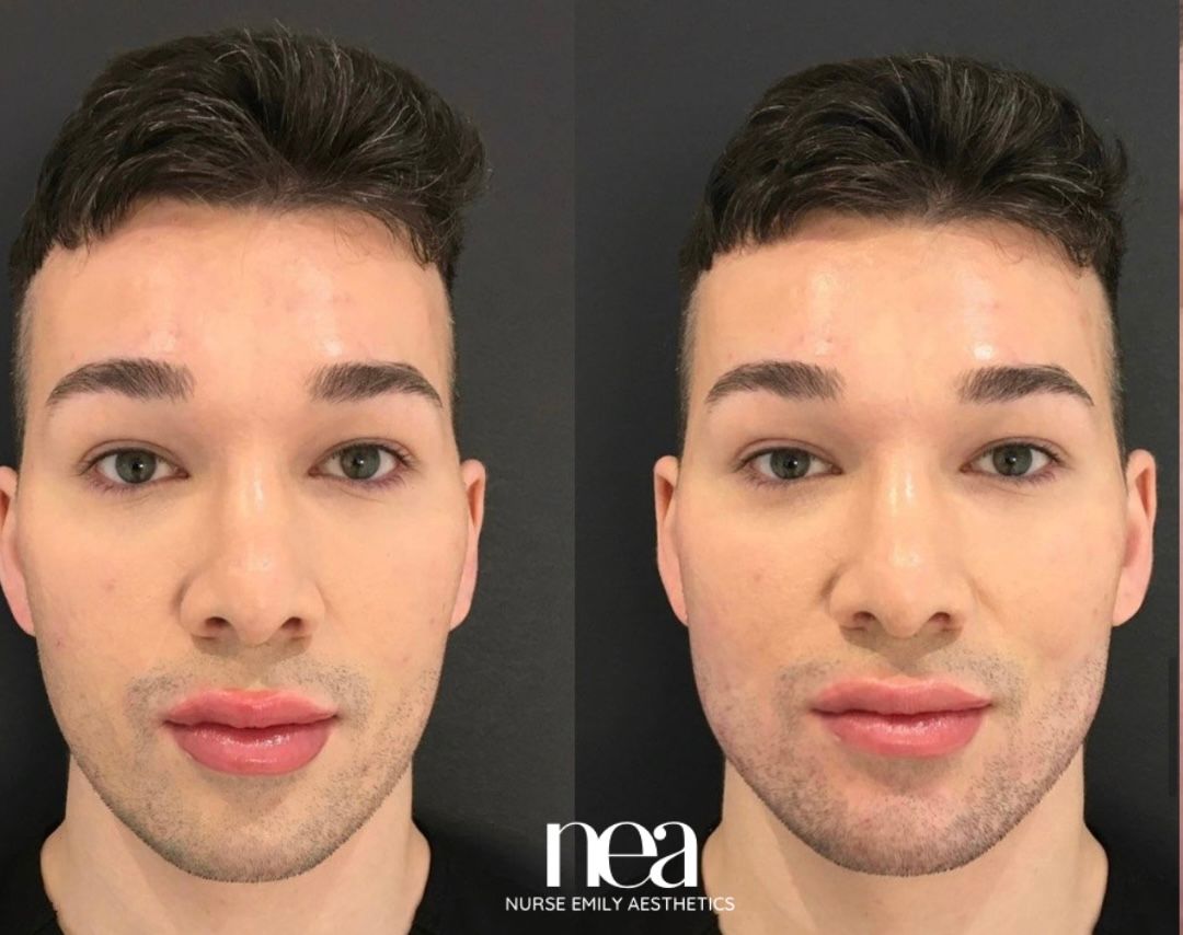 A before and after photo of a man 's face.