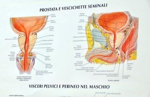 volantino di prostata e vescichette seminali