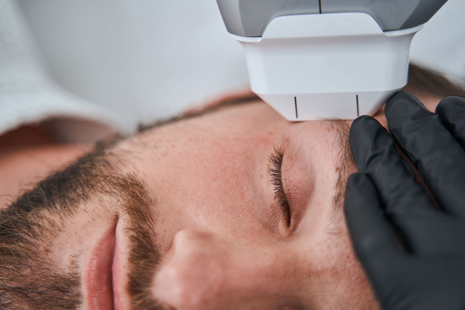 A man is getting a laser treatment on his face.