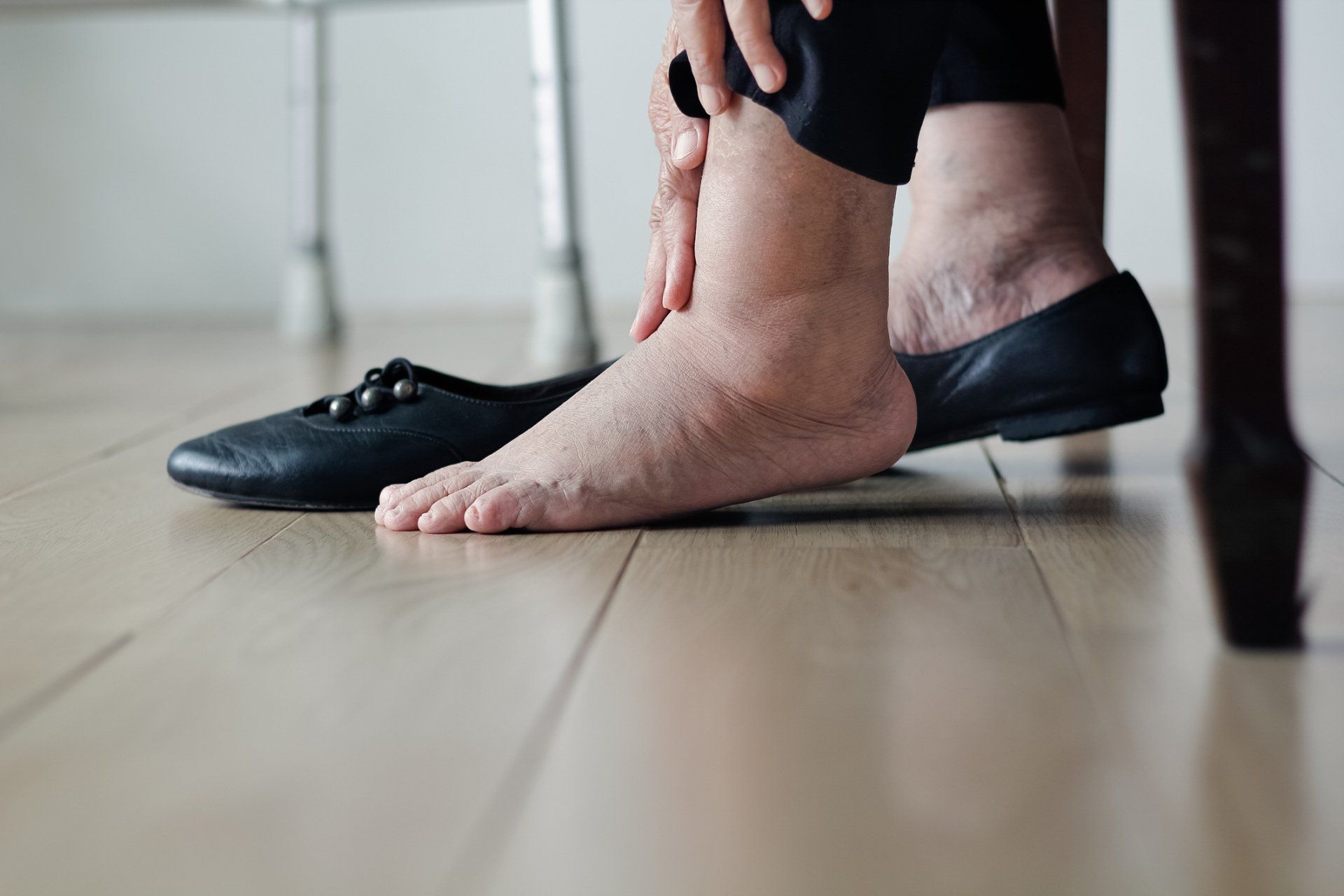 Feet of Diabetic Person — Brisbane, Qld — McLean & Partners Podiatrists