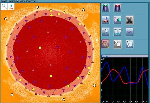 Schnitt durch eine Arterie