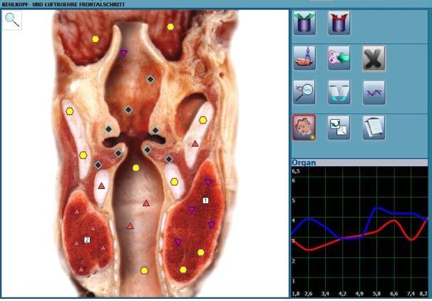 Ein Computerbildschirm zeigt ein Bild eines menschlichen Torsos