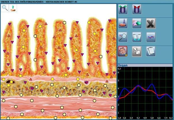 Auf einem Computerbildschirm werden ein Bild eines Magens und ein Diagramm angezeigt.