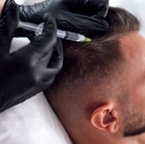 Hair Restoration in Prospect CT