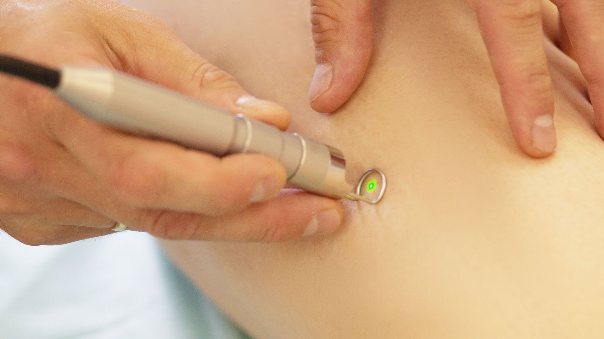 Taking Spider Vein Treatment — Irving, TX — Dr. Reddy Medspa