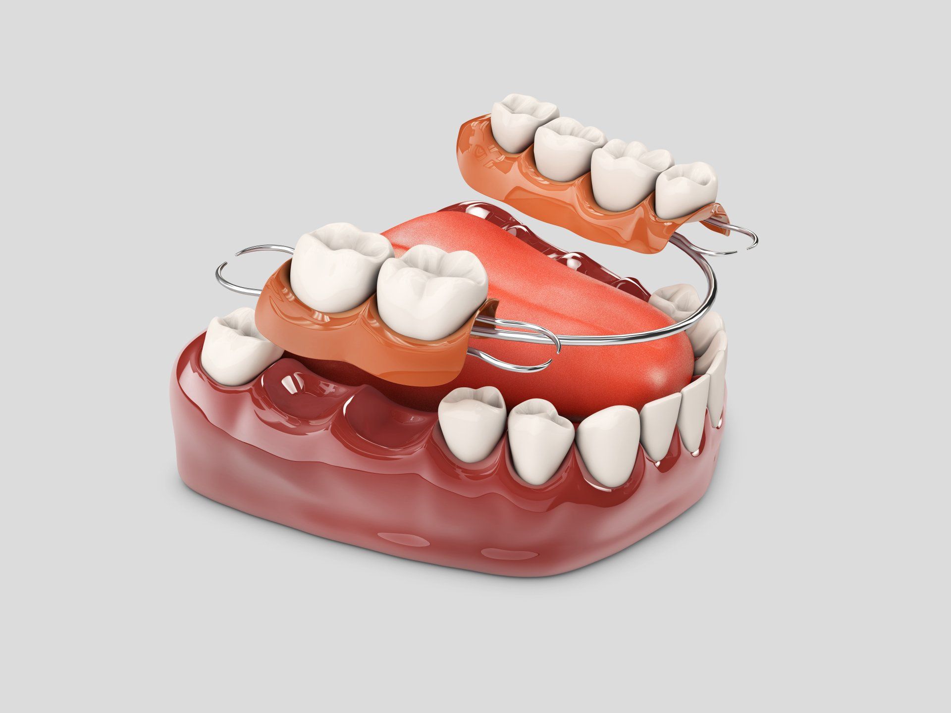 partial dentures model