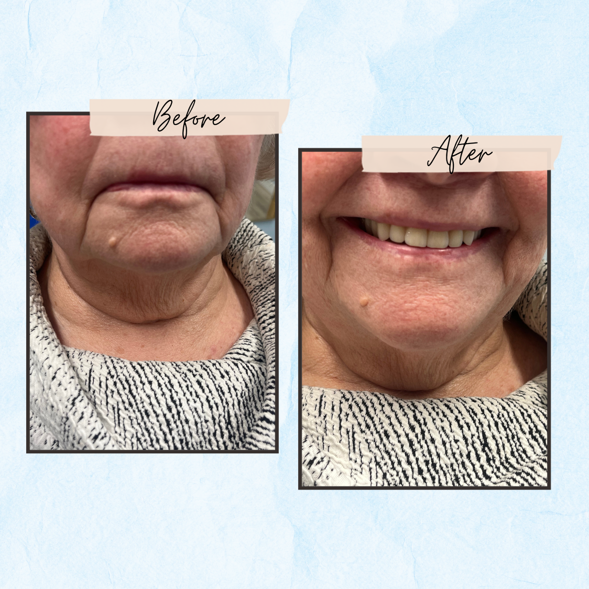 A before and after photo of a woman 's face