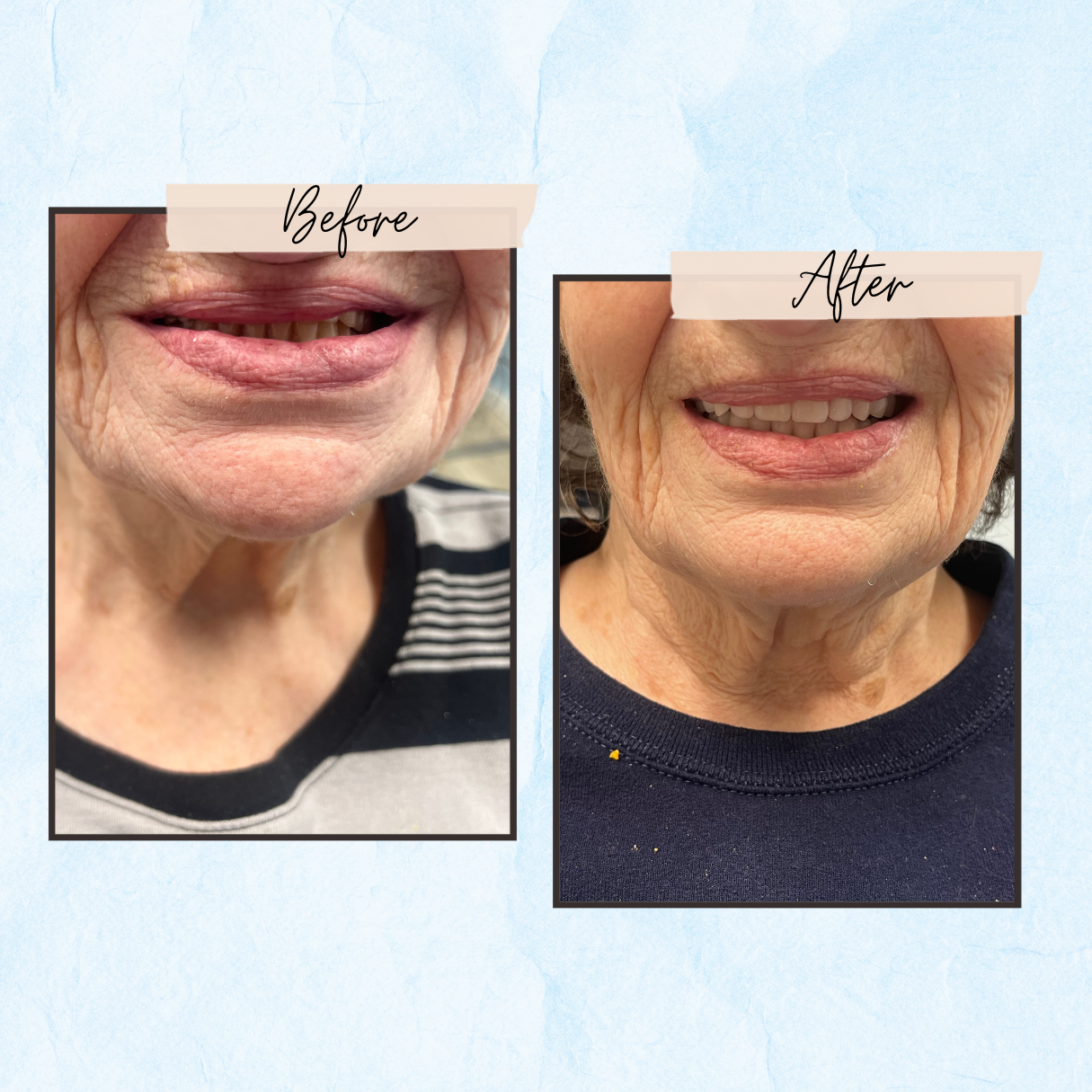 A before and after photo of a woman 's face