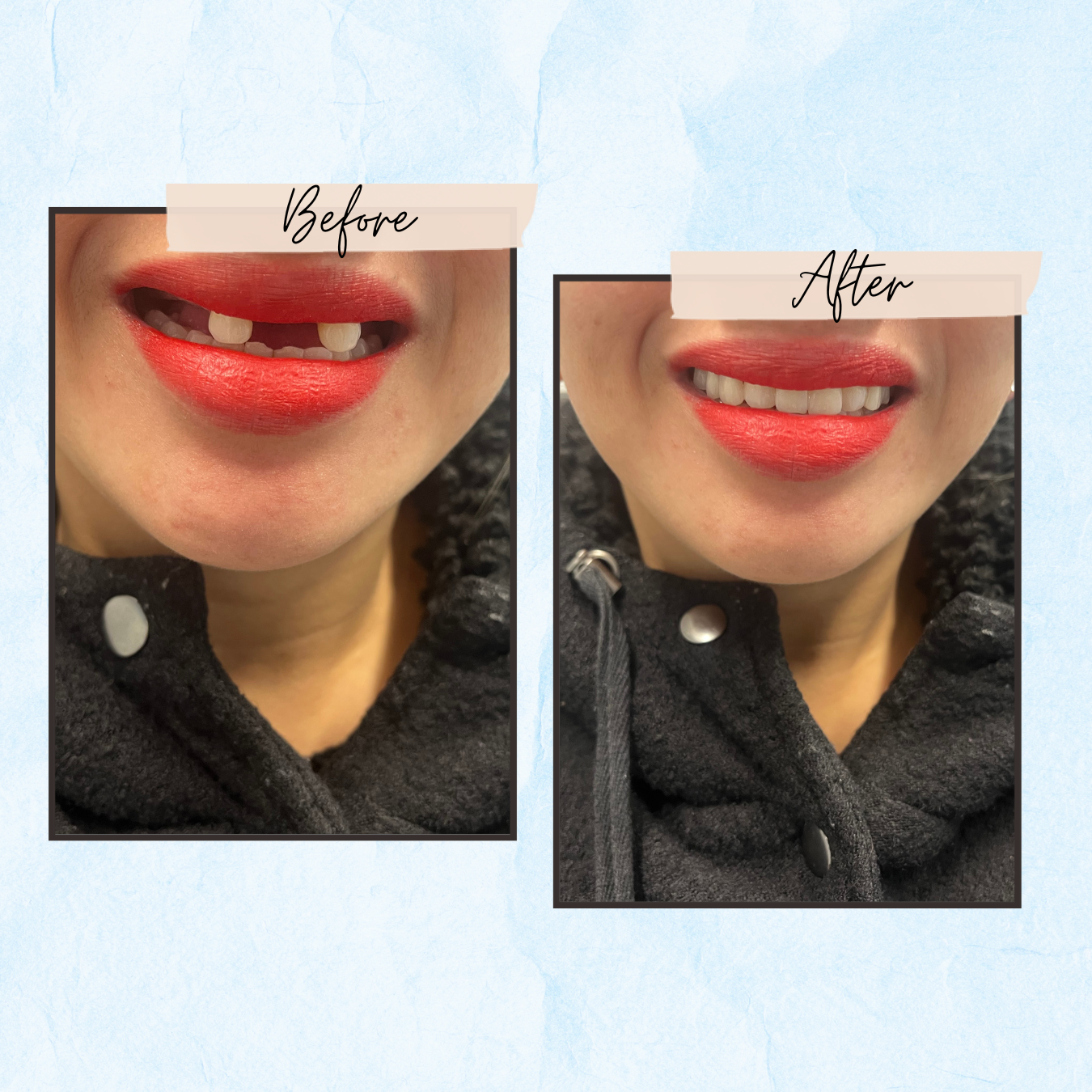 A before and after photo of a woman with red lipstick