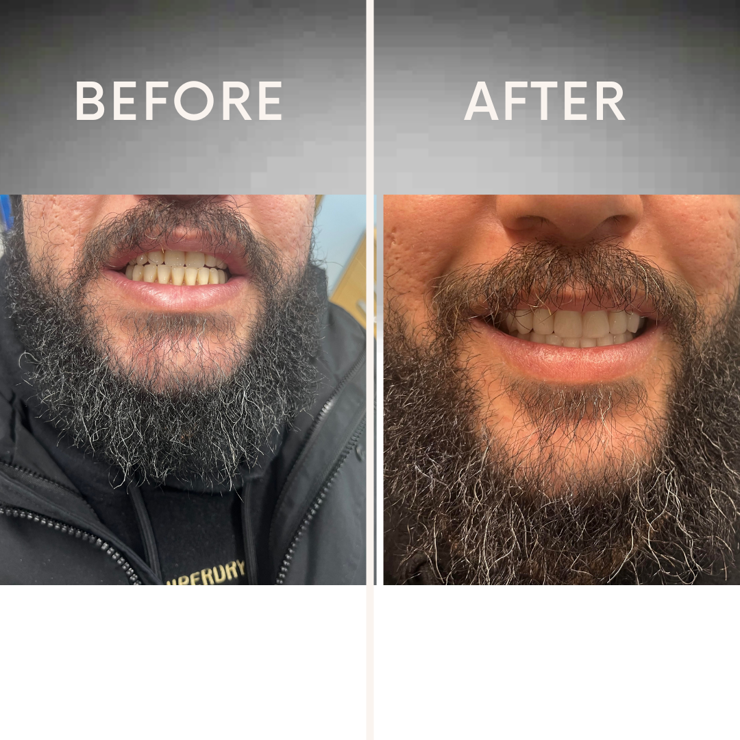 A before and after picture of a man with a beard