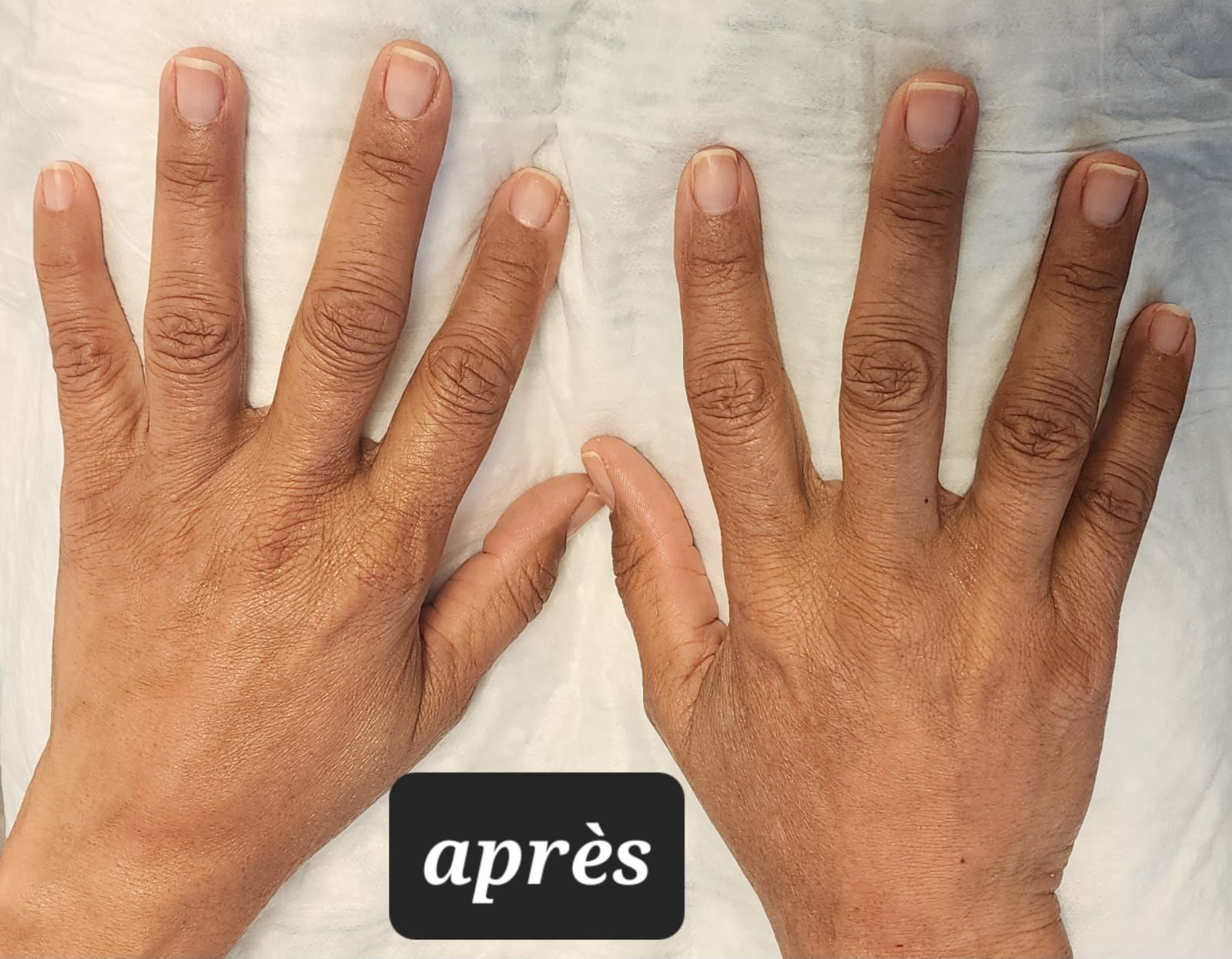 agent de comblement, mains