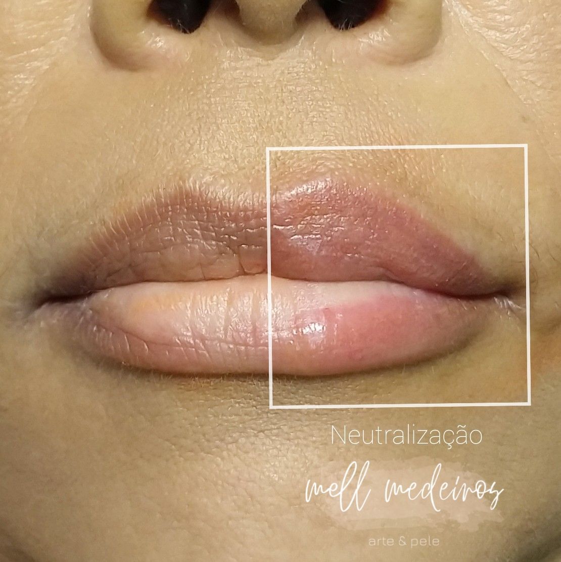 Micropigmentation des Lèvres (Lip Blush) - Melissa Medeiros - Mell Medeiros