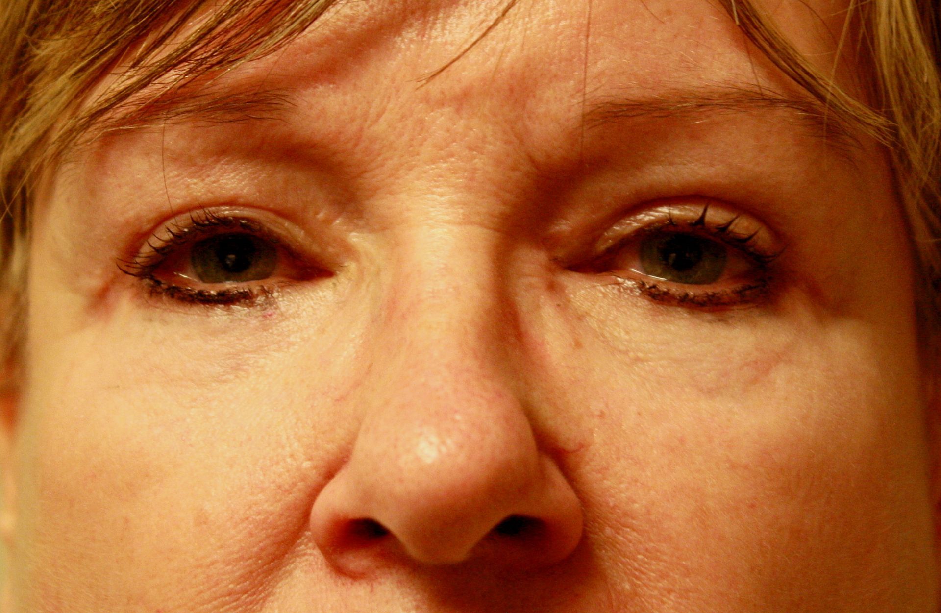 transposition de gras