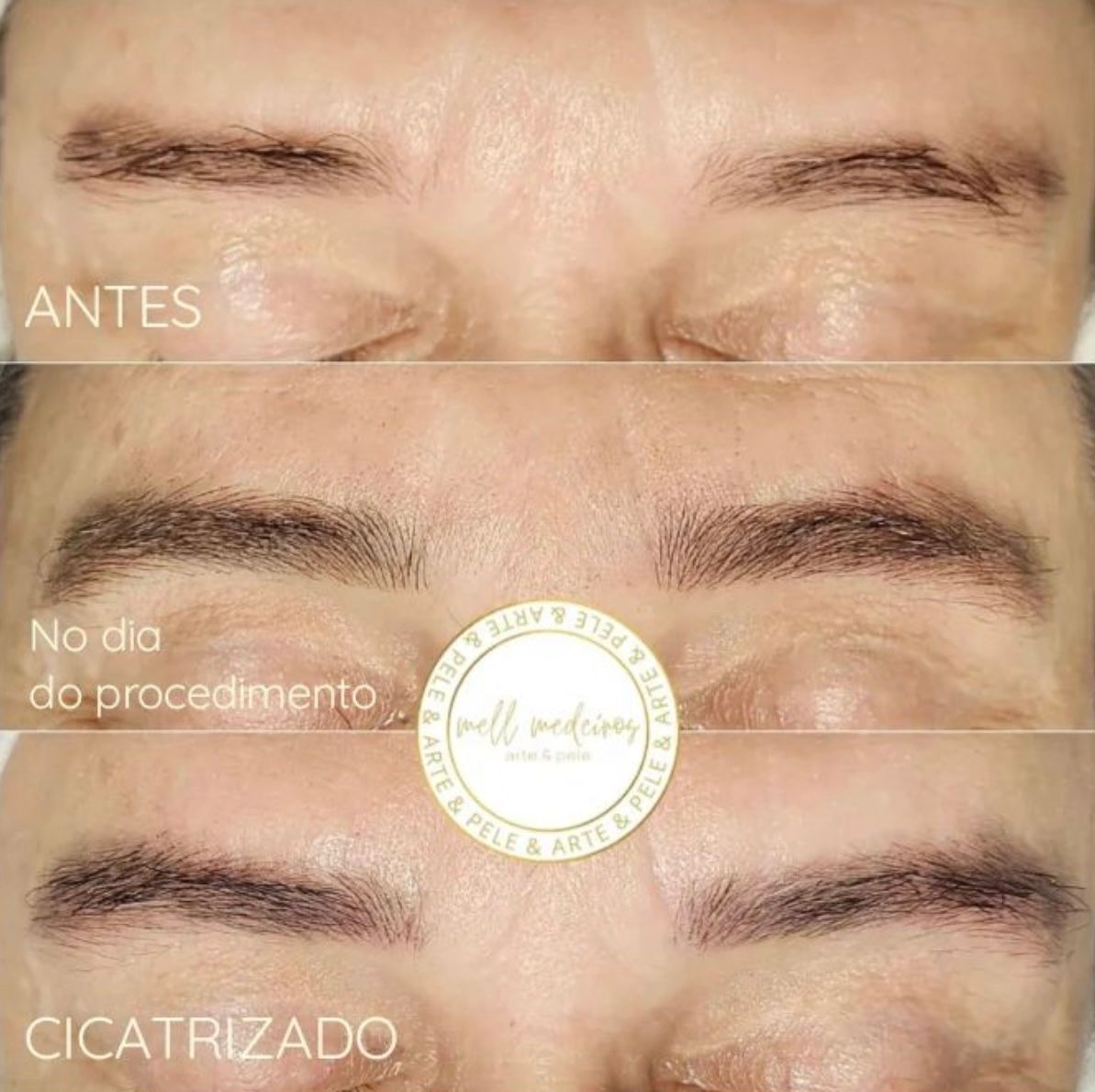 Micropigmentation des Sourcils pour Hommes - Melissa Medeiros - Mell Medeiros