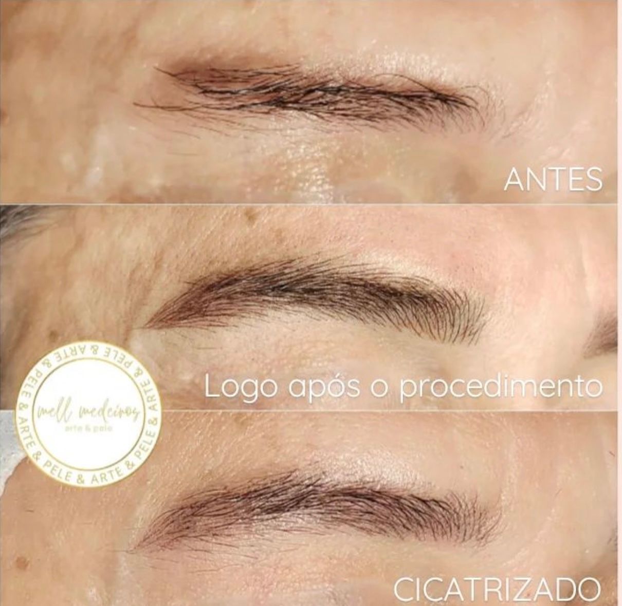 Micropigmentation des Sourcils pour Hommes - Melissa Medeiros - Mell Medeiros