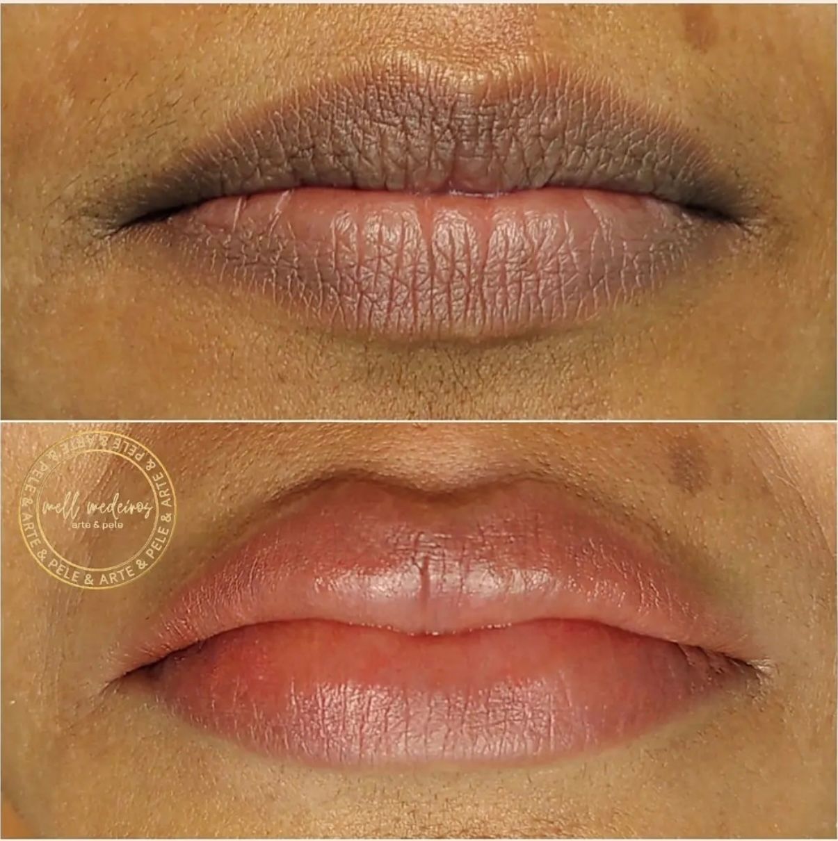 Micropigmentation des Lèvres (Lip Blush) - Melissa Medeiros - Mell Medeiros